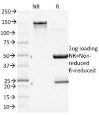 Data from SDS-PAGE analysis of Anti-GAD2 antibody (Clone GAD2/1960). Reducing lane (R) shows heavy and light chain fragments. NR lane shows intact antibody with expected MW of approximately 150 kDa. The data are consistent with a high purity, intact mAb.